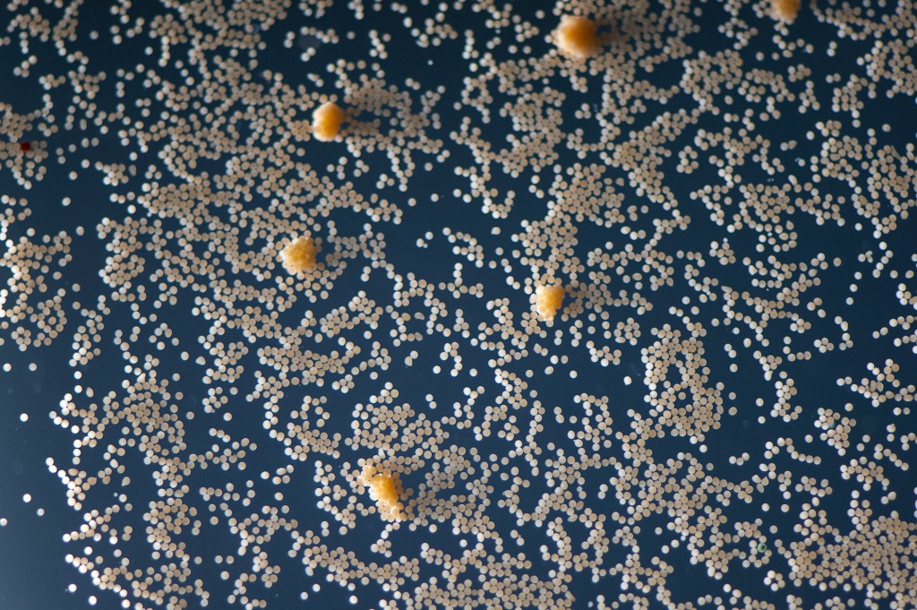 ภาพระยะใกล้ของไข่ที่ได้รับการปฏิสนธิของปะการังเอลคอร์น ภาพถ่าย© Paul Selvaggio / SECORE International
